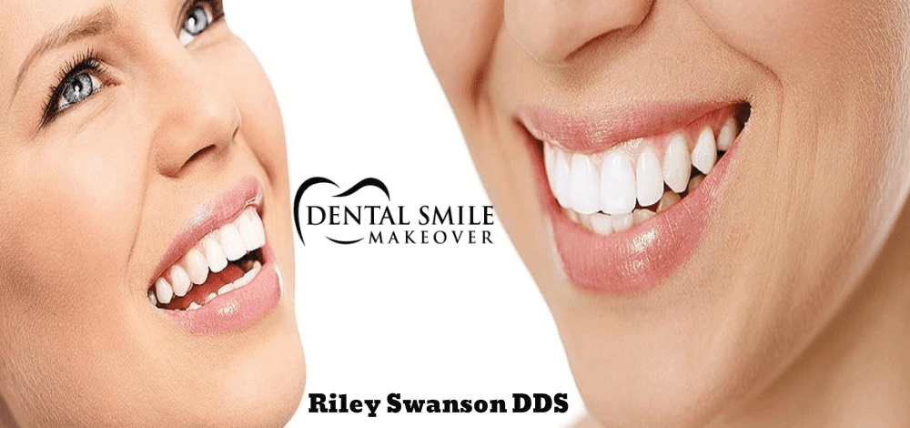 Dental Smile Makeover