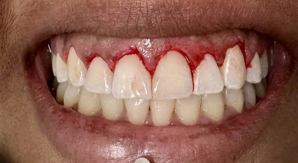 Celebrate Dental & Braces