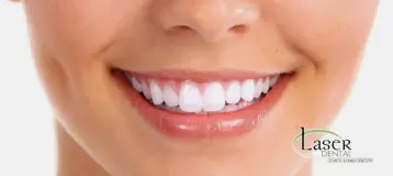 Laser Dental