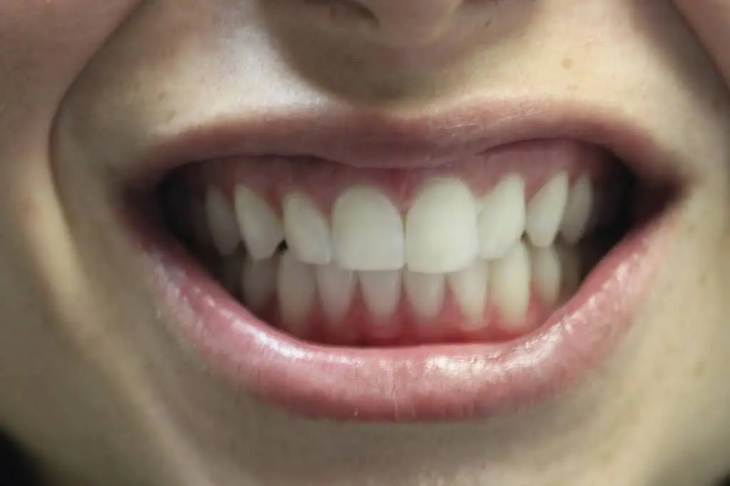Laser Dental