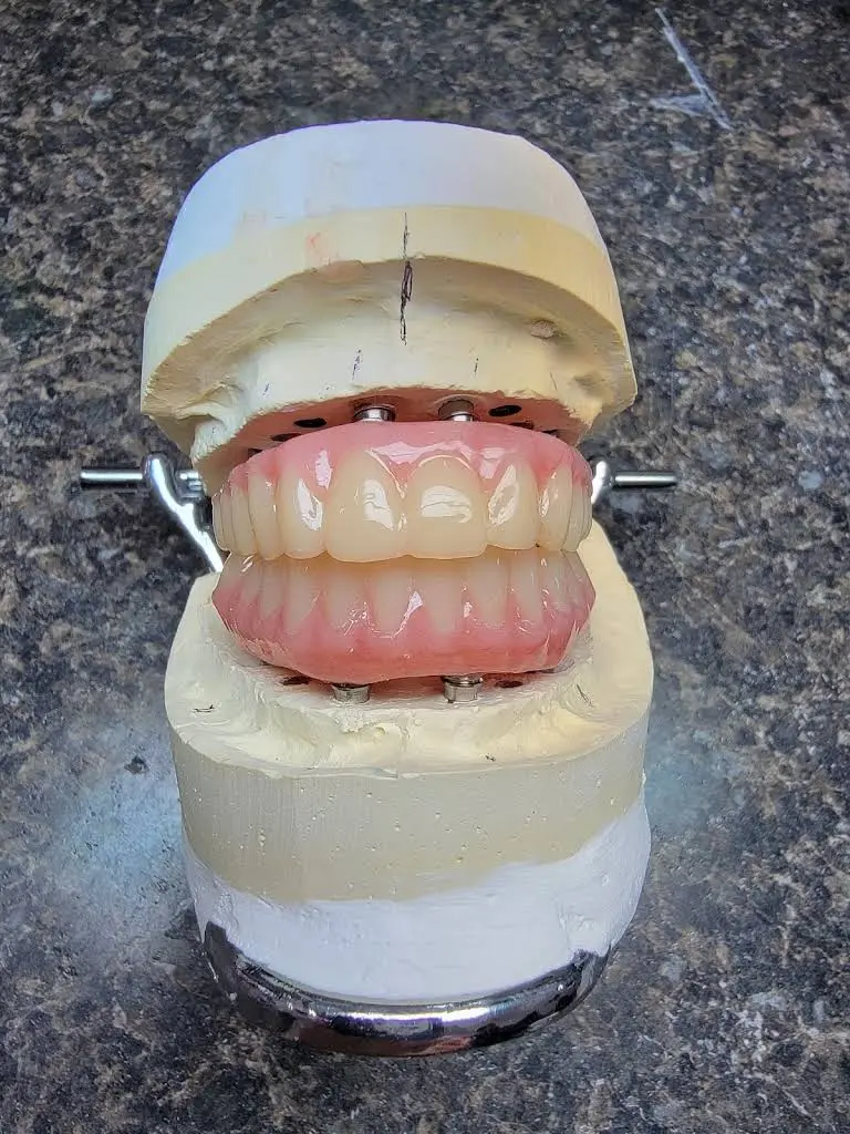 Affordable Dentures & Implants
