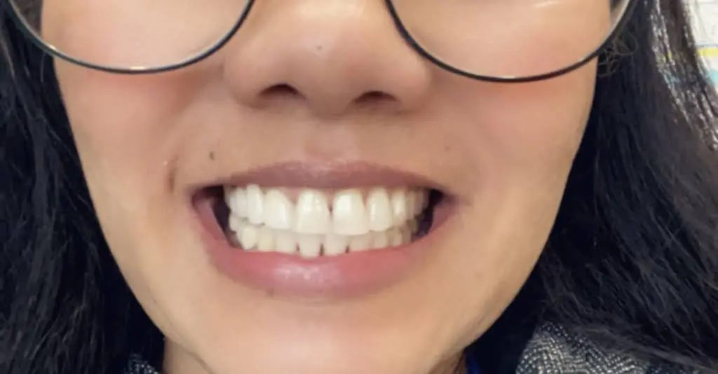 Bliss Dental LV