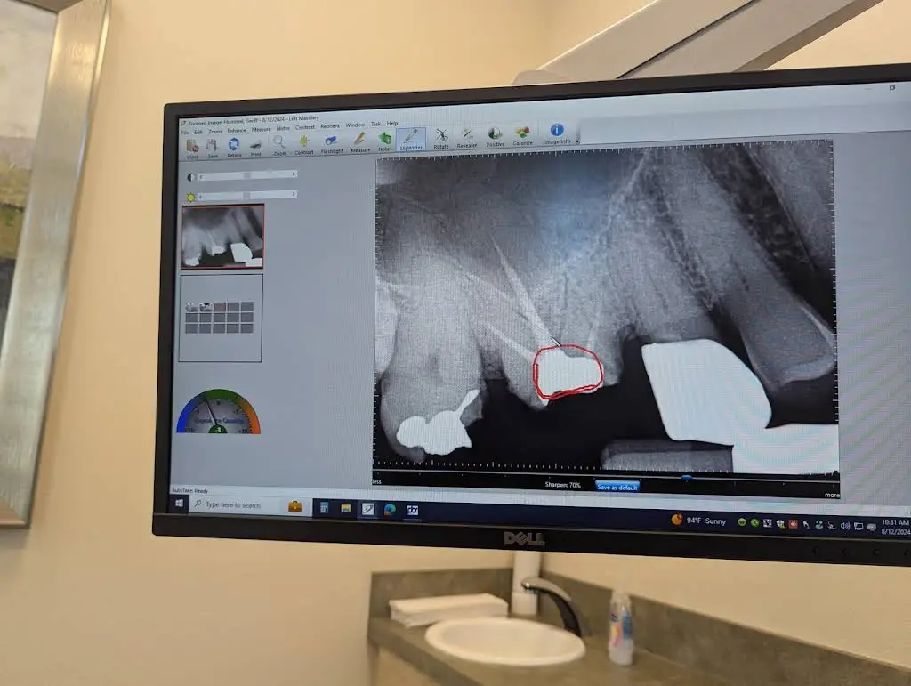 Fife and Steffen Endodontics