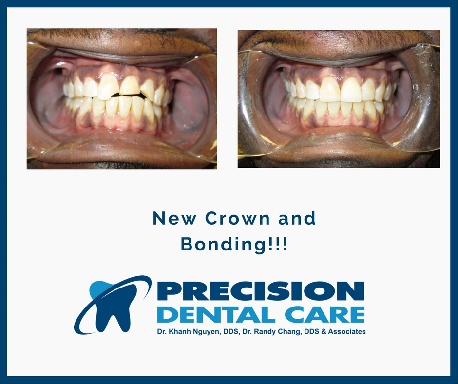 Precision Dental Care