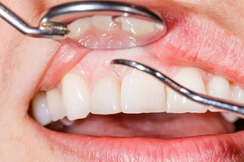 Precision Oral Surgery and Implants