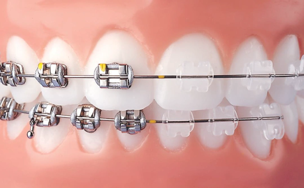 Braces Boutique