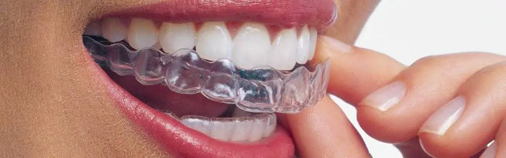Braces Boutique