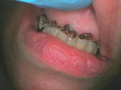 Woodridge Family Dental