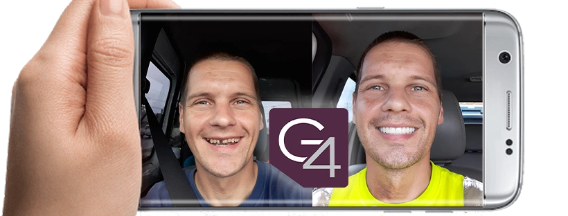 G4 Dental Implants