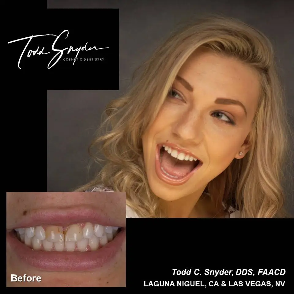 Dr. Snyder Cosmetic Dentistry Las Vegas / Concierge Cosmetic Dentistry