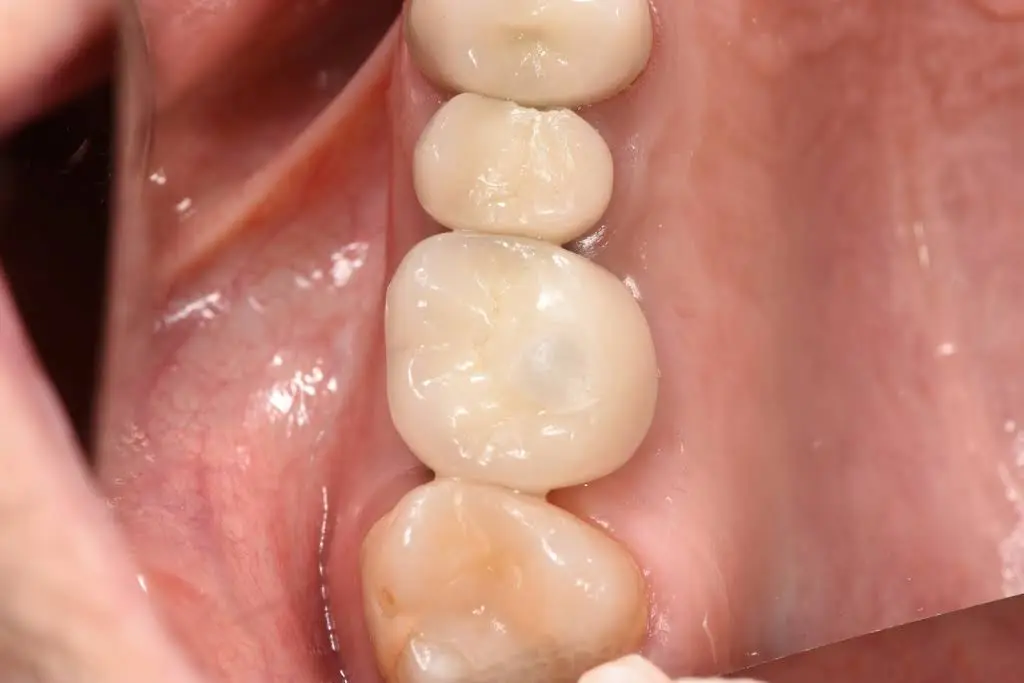 Healthy Smiles Dental - Las Vegas Dentist