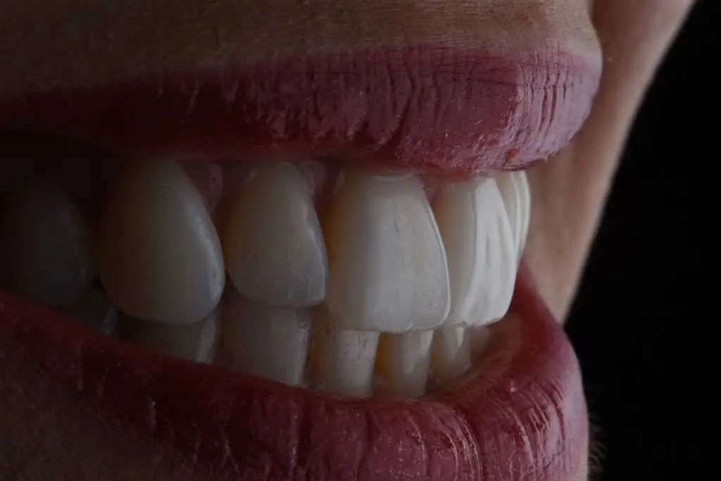 Healthy Smiles Dental - Las Vegas Dentist