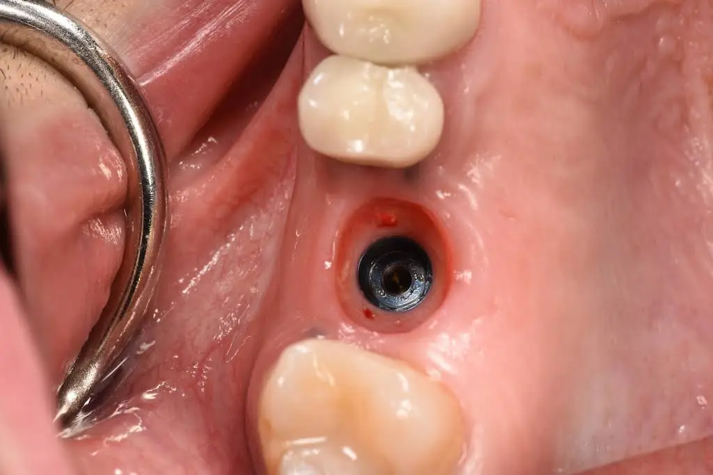 Healthy Smiles Dental - Las Vegas Dentist