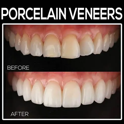Healthy Smiles Dental - Las Vegas Dentist