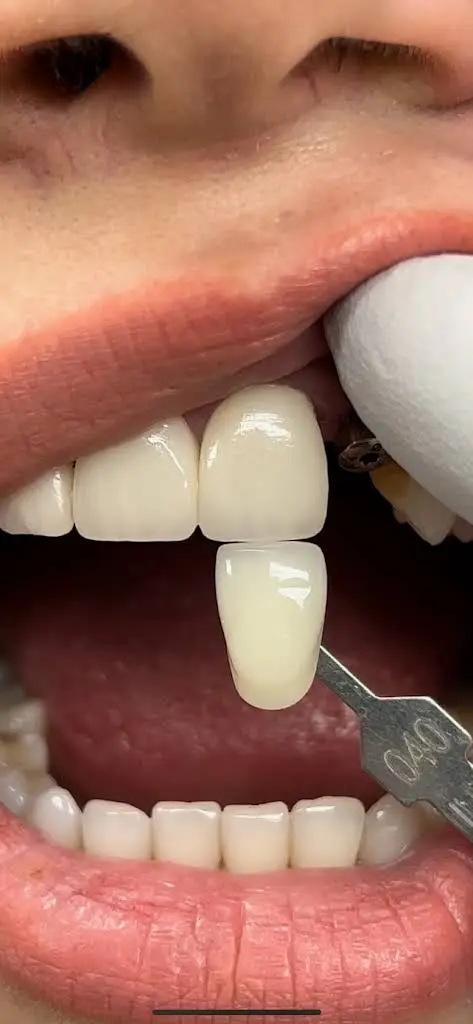 EvoDent Dental Lab