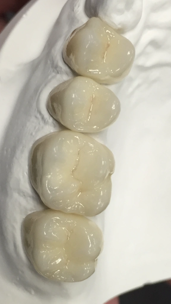 EvoDent Dental Lab