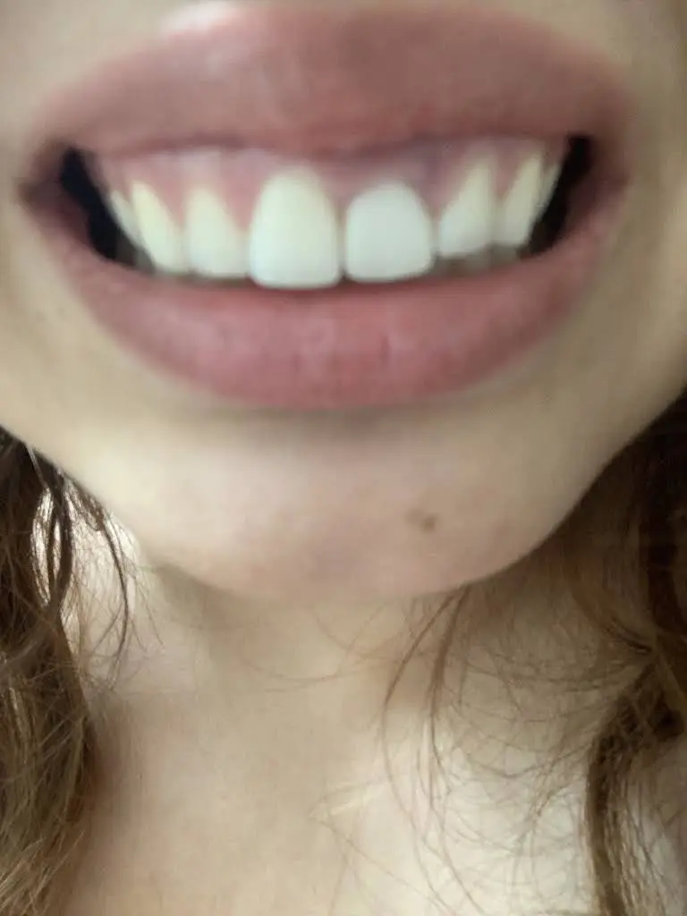 EvoDent Dental Lab