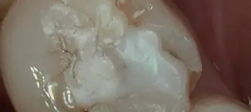 Elder Dental Group