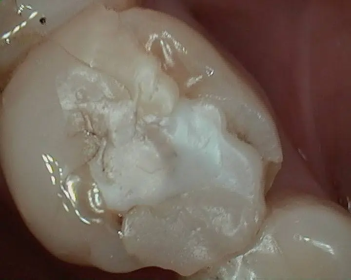 Elder Dental Group