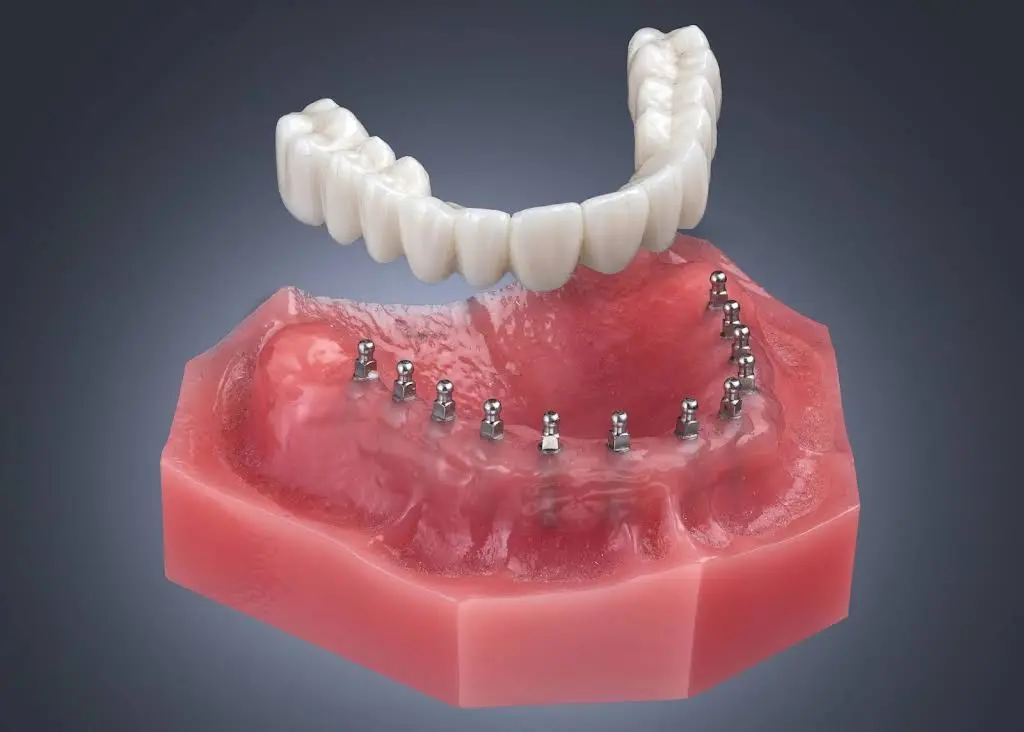 Vegas Dental Experts