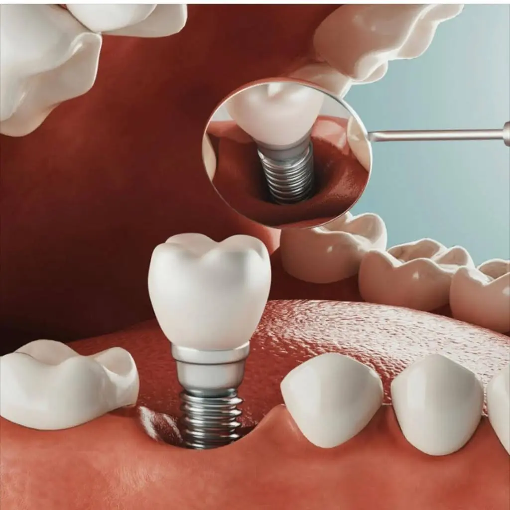 Vegas Dental Experts