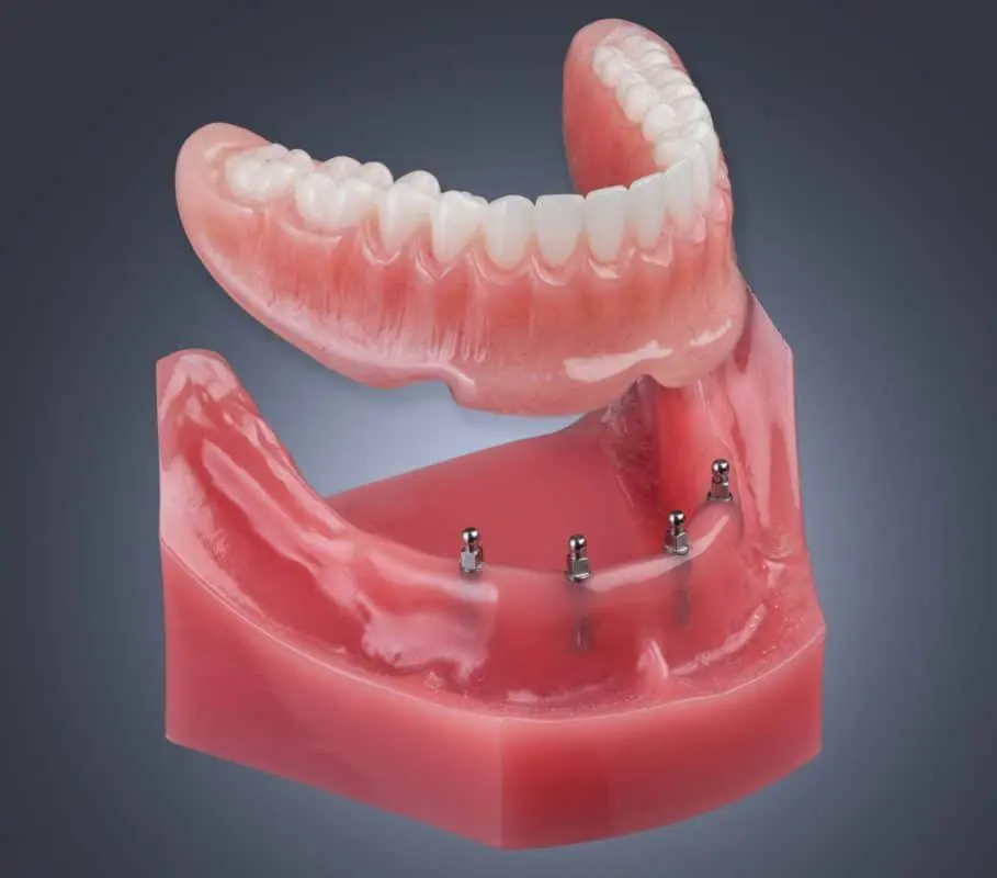 Vegas Dental Experts