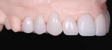 Almont Dental