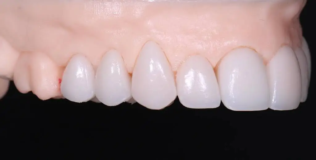 Almont Dental