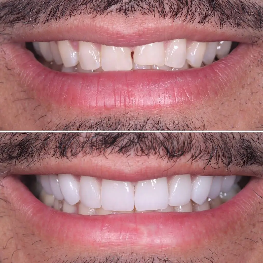Almont Dental
