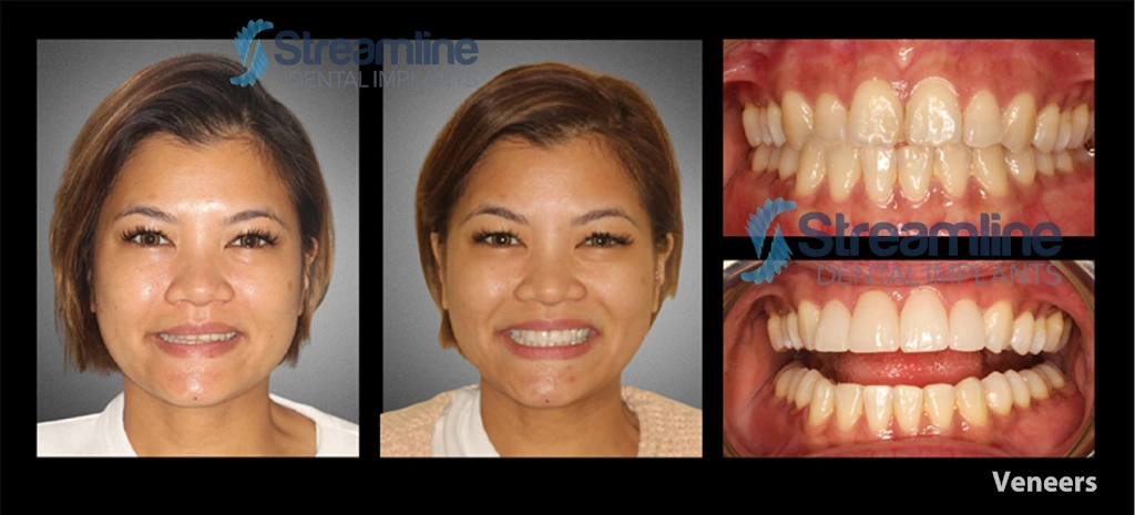Dentistry For Children