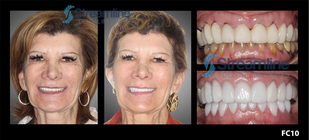 Dentistry For Children