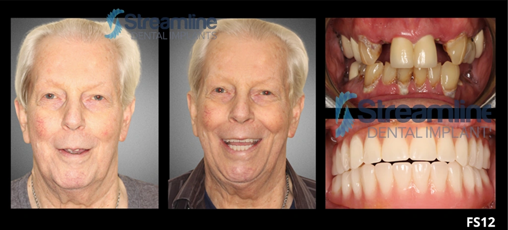 Dentistry For Children