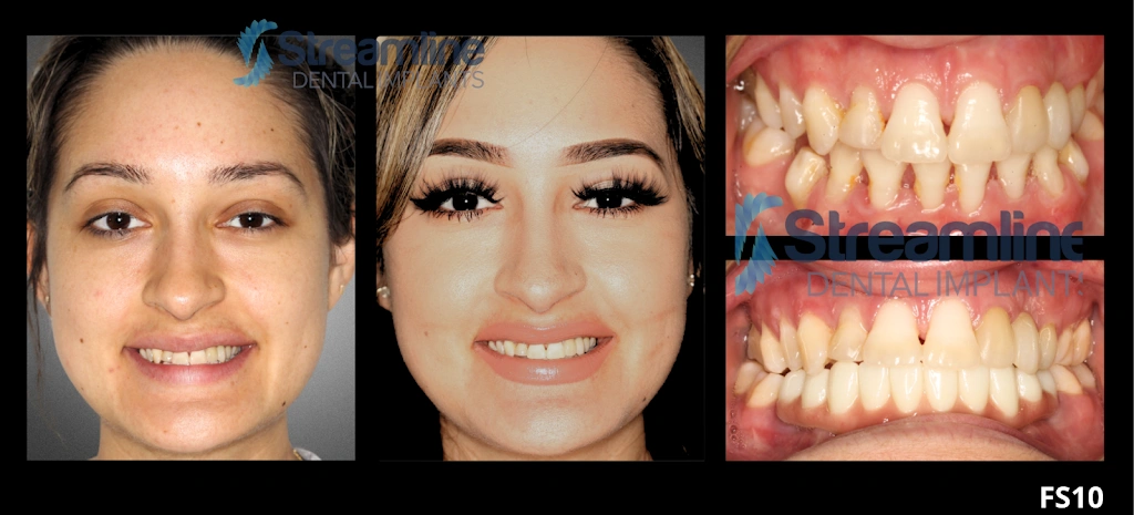 Dentistry For Children