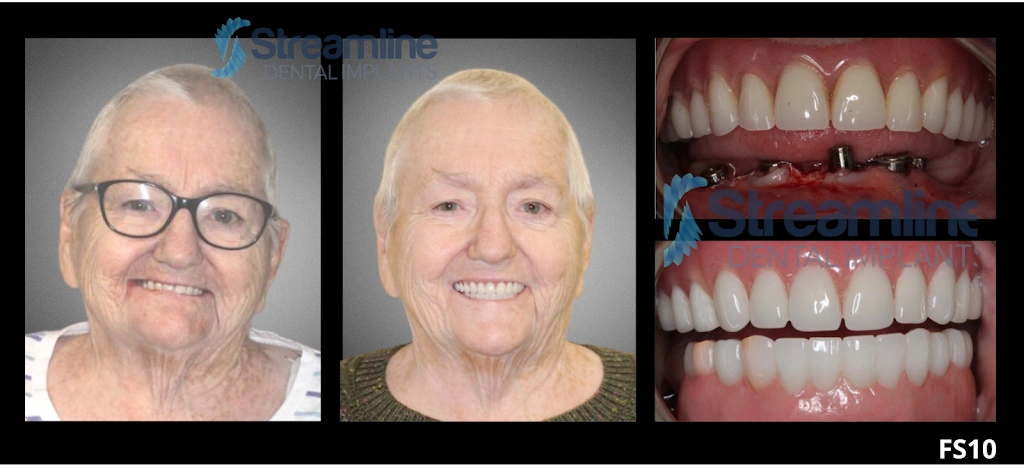 Dentistry For Children