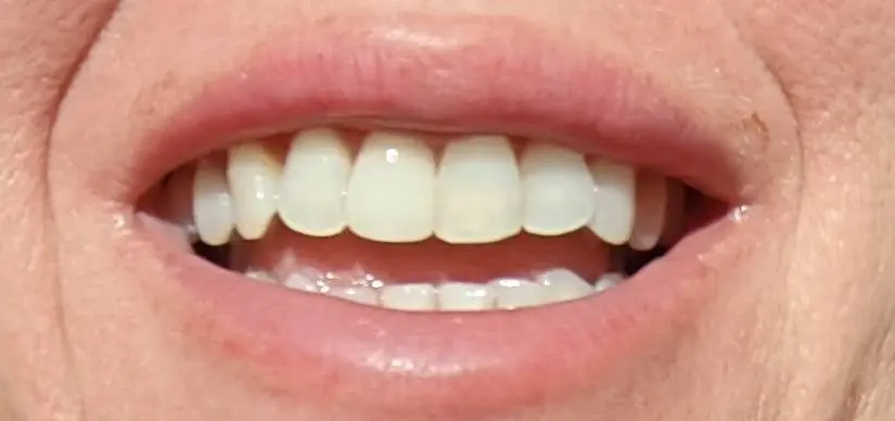 Sunstone Dental Care
