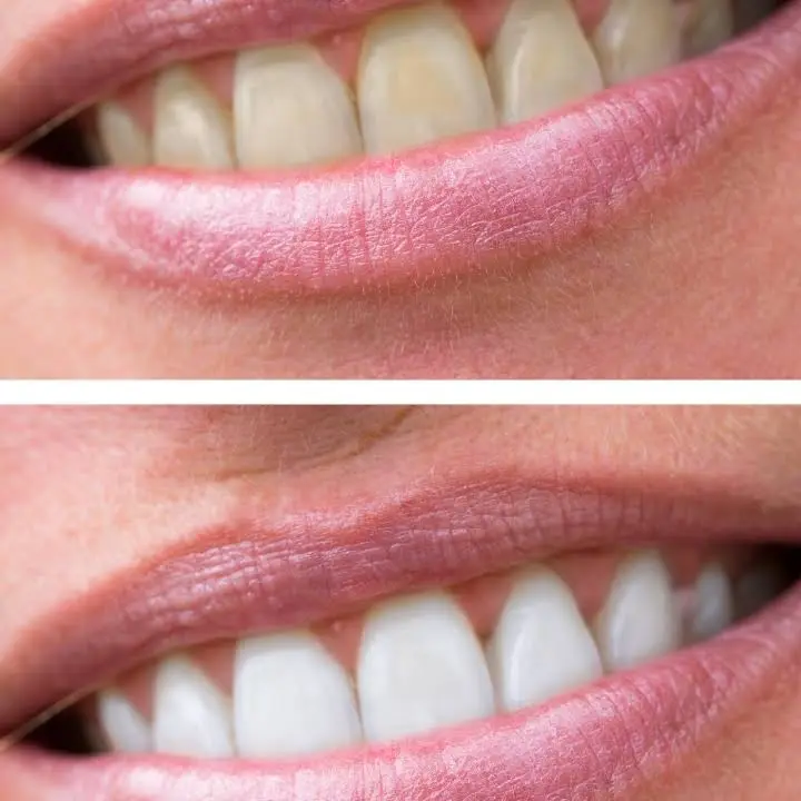Black Mountain Dental - Henderson