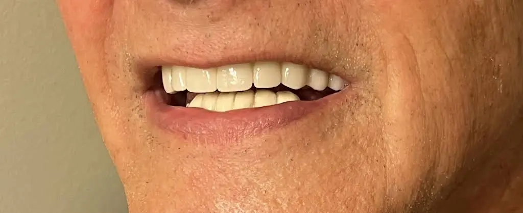 Palatine Dental Associates
