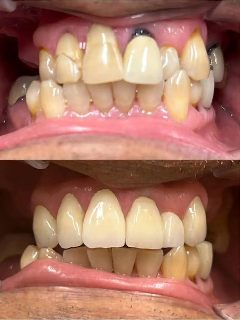Portage Family Dental