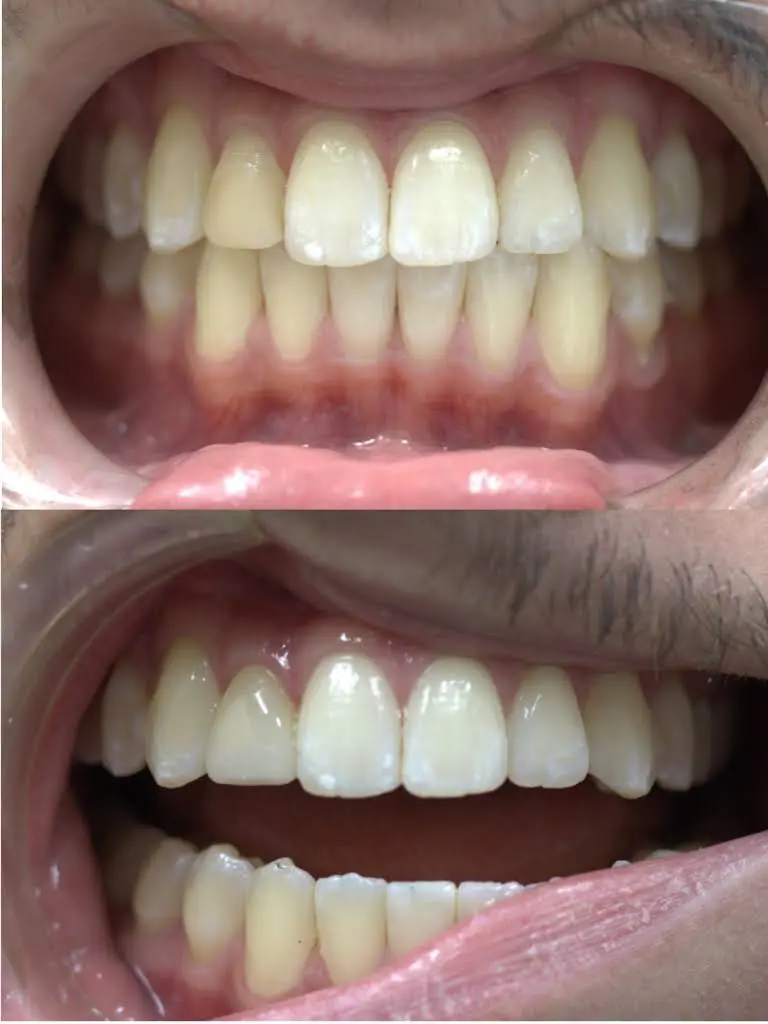 Portage Family Dental
