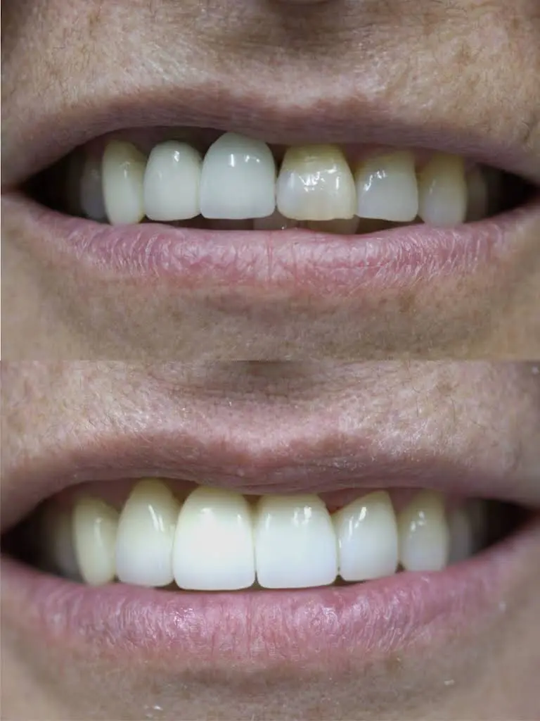Portage Family Dental