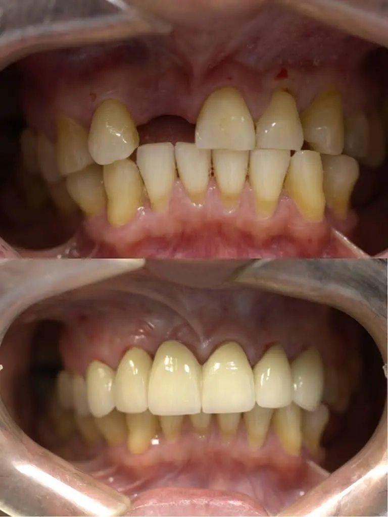Portage Family Dental