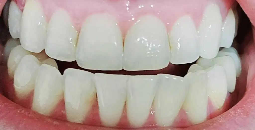 Family Dental Care Park Ridge