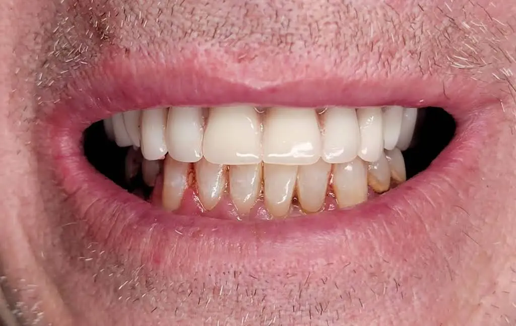 Central Dental Associates