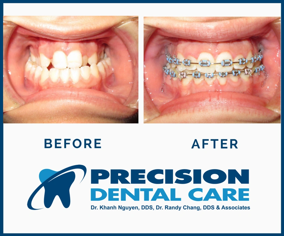 Precision Dental Care W Cermak Rd