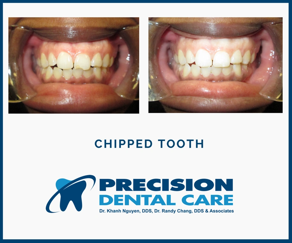 Precision Dental Care W Cermak Rd