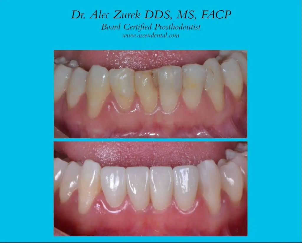 Ascend Dental - Dr. Zurek and Dr. Sikora