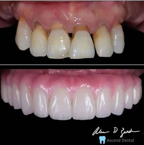 Ascend Dental - Dr. Zurek and Dr. Sikora
