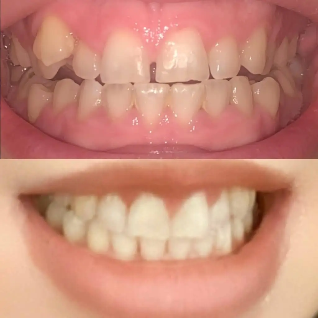 Modern Dental Care