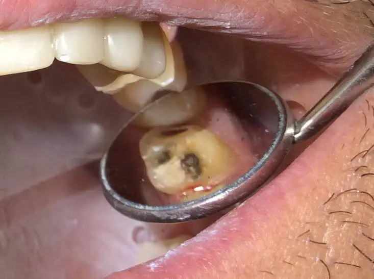 Dee for Dentist
