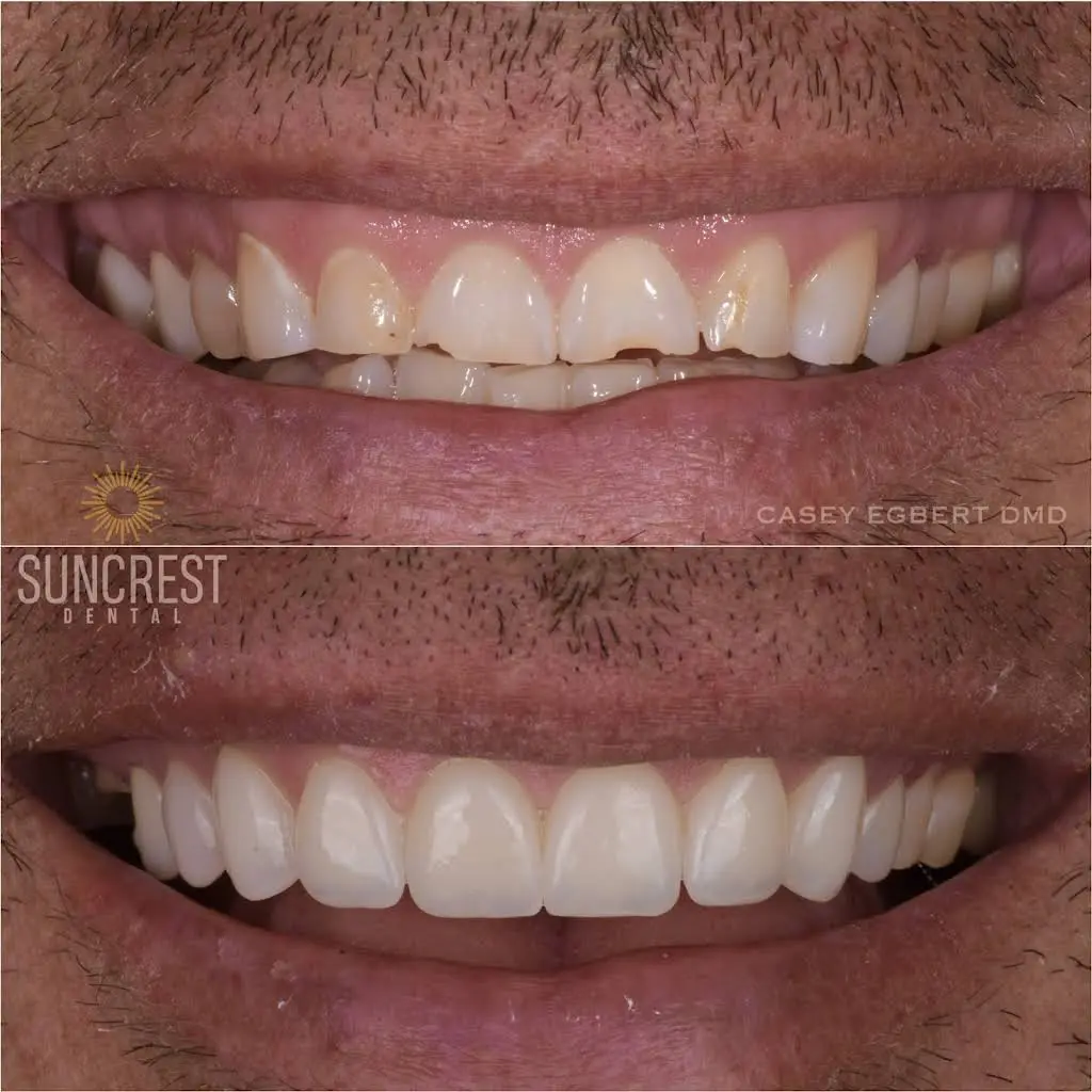 Suncrest Dental